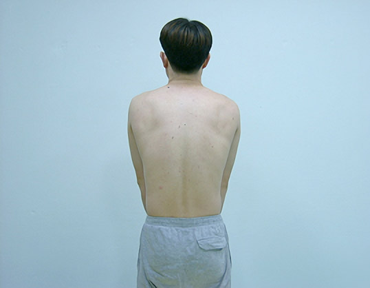 견갑골의 전인 운동